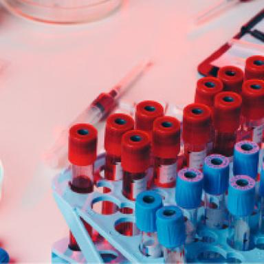 Blood Tubes, Needles and Racks